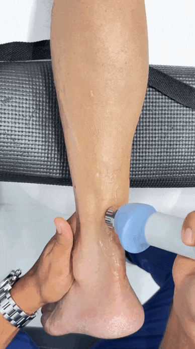 ondas de choque aquiles bogota tendinitis espolon