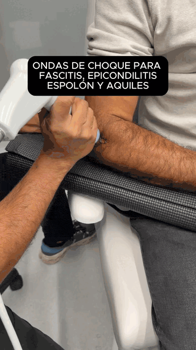 ondas de choque epicondilitis codo bogota precio